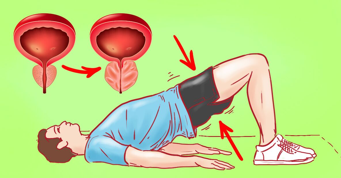 Gymnastics exercises for prostatitis